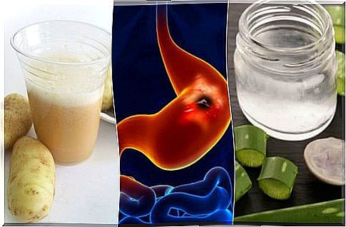 5 Home Remedies for Stomach Ulcer Relief