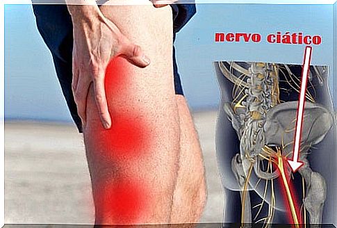 Home and Natural Remedies to Relieve Sciatica Pain