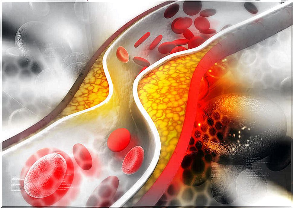 Cholesterol influences arthritis control