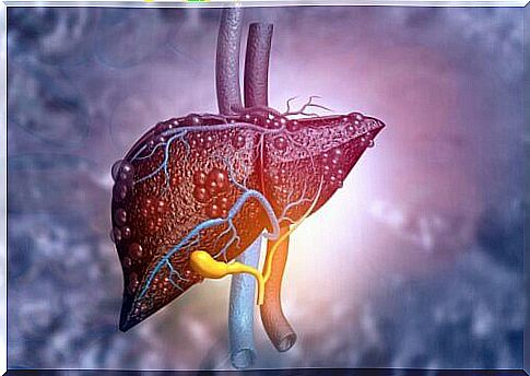 liver with cirrhosis