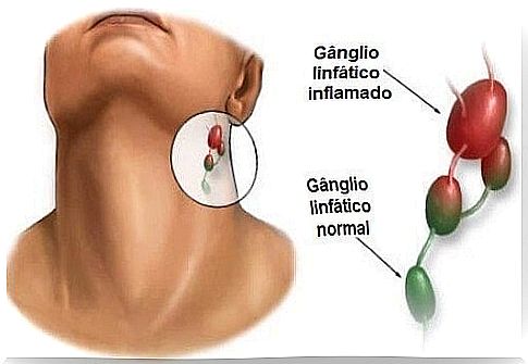 Lymph Nodes: Find Out What Causes Inflammation