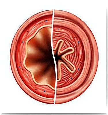 Antiasthmatics open the trachea