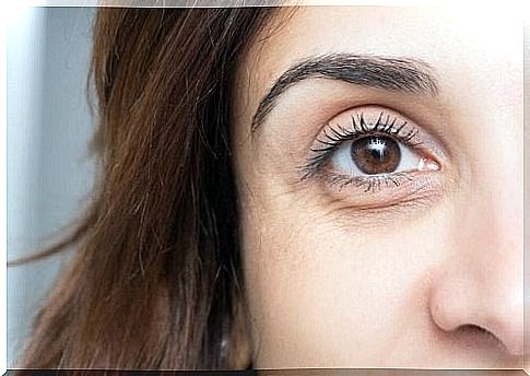 Woman who cannot avoid bags and dark circles