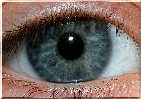 Blue eye analyzed by Iridology